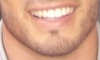 A close up of my smile