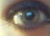 Ohhh my eye!